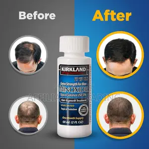 Kirkland Minoxidil 5% for Beard Hair Growth Made in Usa