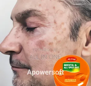 Active Mesta and All Spot Out Nourishing Skin Cream Indian