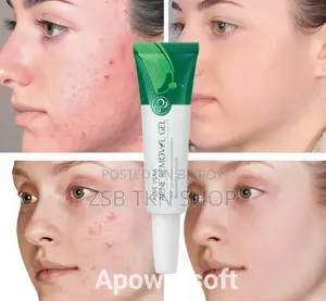 Aloe Vera Acne Removal Gel