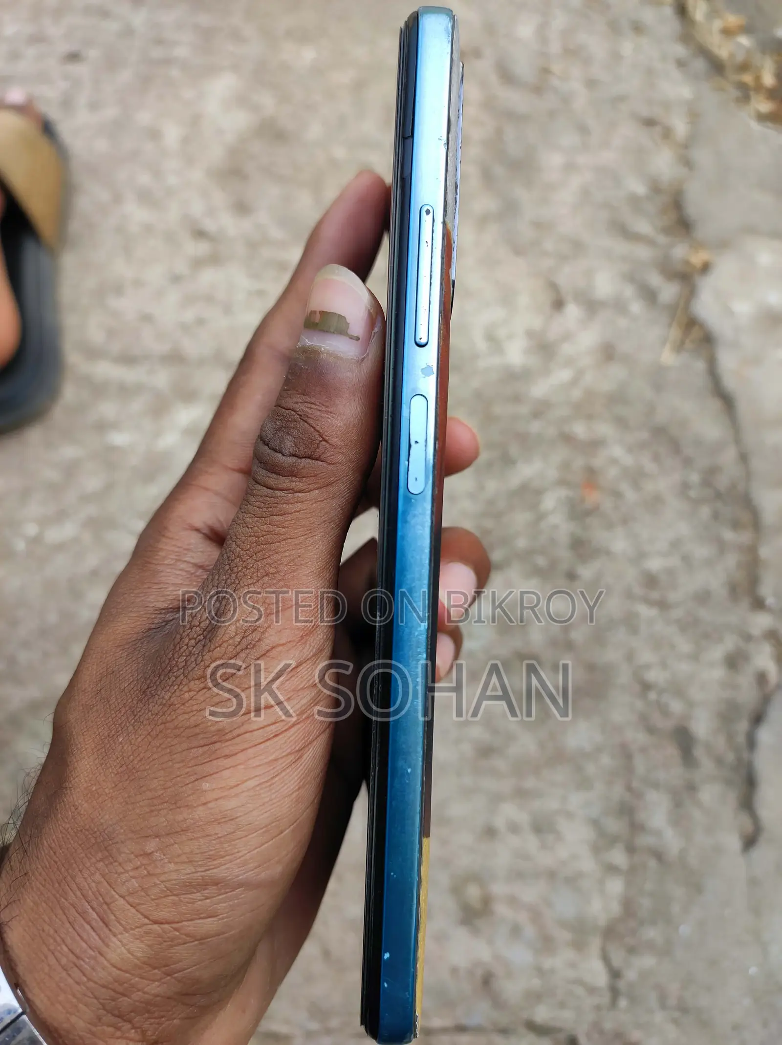 Xiaomi Redmi Note 11 Ram 4/64 (Used)