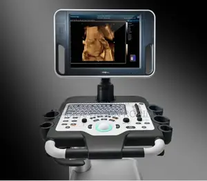 Dc- 30 Full Hd আল্ট্রাসাউন্ড মেশিন