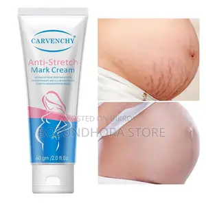 Anti-Stretch Mark Cream