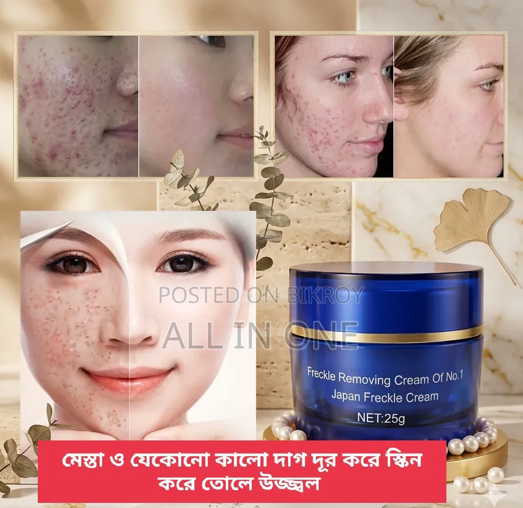 Anti Freckle Whitening Cream Blue