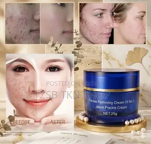 Anti Freckle Whitening Cream Blue New Update