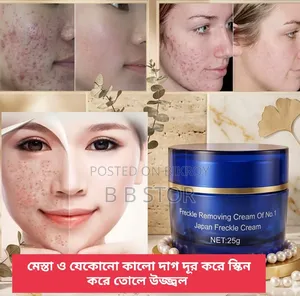 Anti Freckle Whitening Cream Blue Mestha