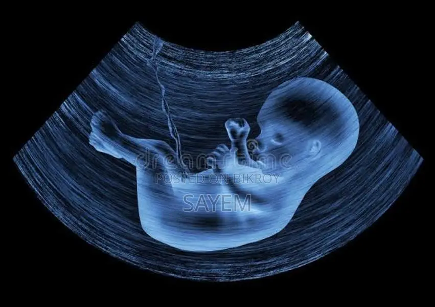 Fetal Doppler