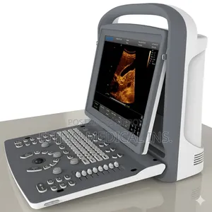 Chison Eco 3 Color Ultrasound Machine