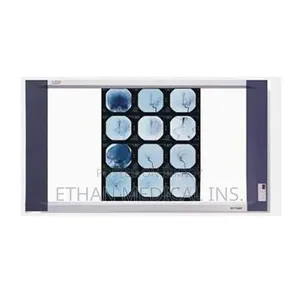 X-Ray Film Viewer Double View Box