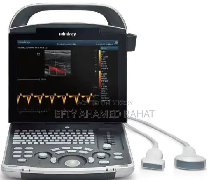 Mindray DP-36 with Whole Abdomen Probe + TVS Probe