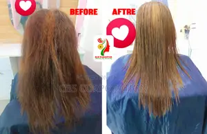Brazilian Botox for with 2 services free.