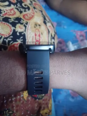 শাওমি ওয়াচ ৫ অ্যাক্টিভ অরিজিনাল ১০০% ২ মাস হলো কেনা হয়েছে