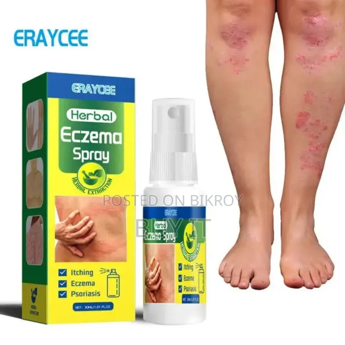 Eraycee Herbal Eczema Spray