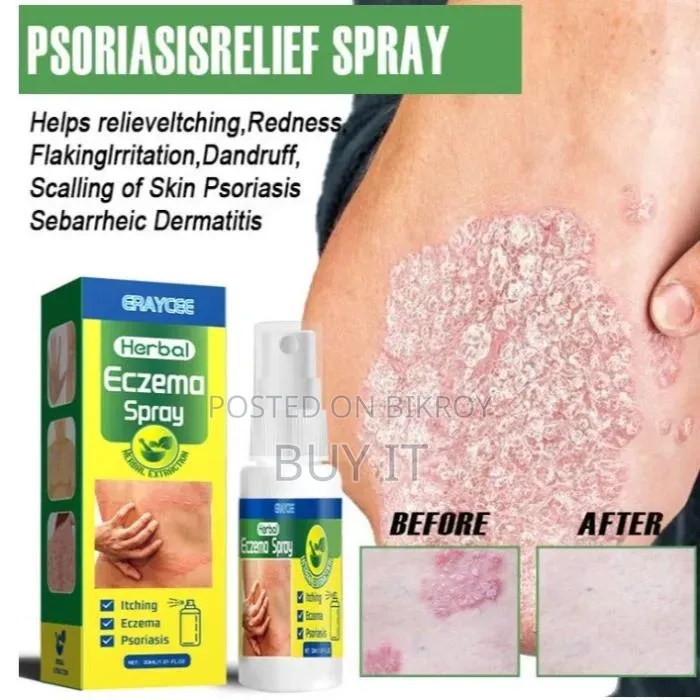 Eraycee Herbal Eczema Spray